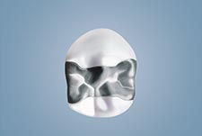 Digitales Röntgen im Zahnzentrum in Hiltrup