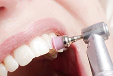 Kariesbehandlung ohne Bohren im Zahnärzte-Zentrum Hiltrup